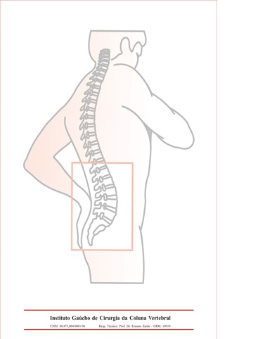 Instituto Gacho de Cirurgia da Coluna Vertebral